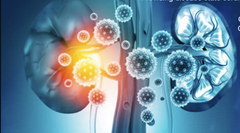How BK PCR Quantitative Serum Testing Works: A Step-by-Step Guide for Transplant Teams